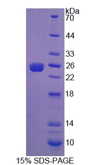 Figure 1. SDS-PAGE