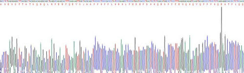Recombinant Human Extracellular Matrix Protein 1 (ECM1)