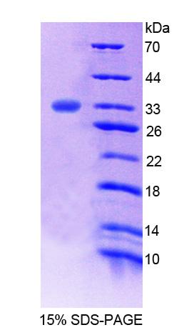 Figure 1. SDS-PAGE