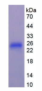 Figure 1. SDS-PAGE