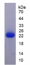 Figure 2. SDS-PAGE