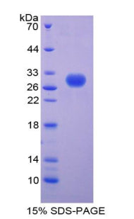 Figure 1. SDS-PAGE