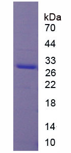 Figure 1. SDS-PAGE
