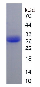 Figure 1. SDS-PAGE
