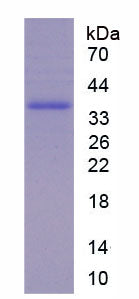 Figure 1. SDS-PAGE