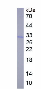 Figure 1. SDS-PAGE