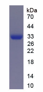 Figure 1. SDS-PAGE