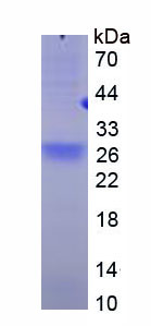 Figure 1. SDS-PAGE