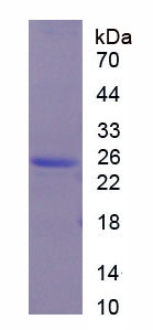 Figure 1. SDS-PAGE