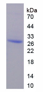 Figure 1. SDS-PAGE