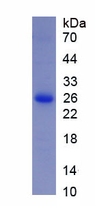 Figure 1. SDS-PAGE