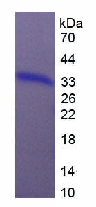Figure 1. SDS-PAGE
