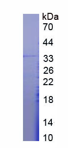 Figure 1. SDS-PAGE