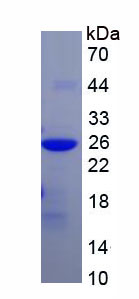 Figure 1. SDS-PAGE