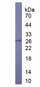 Figure 1. SDS-PAGE