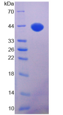 Figure . SDS-PAGE