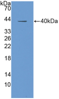Figure . Western Blot