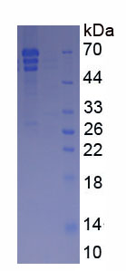 Figure . SDS-PAGE