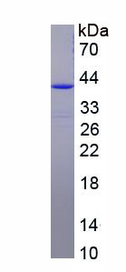 Figure . SDS-PAGE