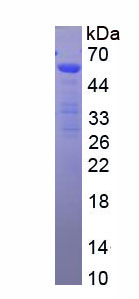 Figure . SDS-PAGE