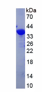 Figure . SDS-PAGE