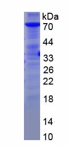 Figure . SDS-PAGE
