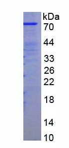 Figure . SDS-PAGE