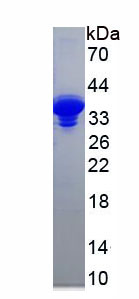 Figure . SDS-PAGE