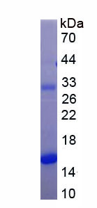 Figure . SDS-PAGE