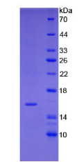 Figure . SDS-PAGE