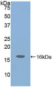 Figure . Western Blot
