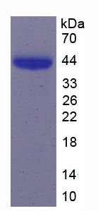 Figure . SDS-PAGE
