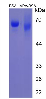 Figure . SDS-PAGE