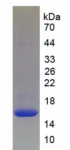Figure . SDS-PAGE