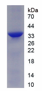Figure . SDS-PAGE