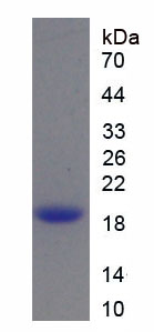 Figure . SDS-PAGE