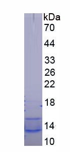 Figure . SDS-PAGE