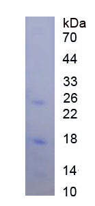 Figure . SDS-PAGE