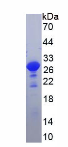 Figure . SDS-PAGE