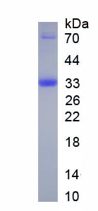 Figure . SDS-PAGE