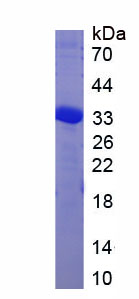 Figure . SDS-PAGE