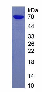 Figure . SDS-PAGE