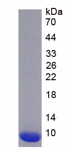 Figure . SDS-PAGE