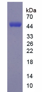 Figure . SDS-PAGE