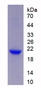 Figure . SDS-PAGE