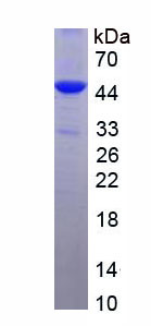 Figure . SDS-PAGE