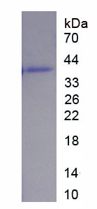 Figure . SDS-PAGE