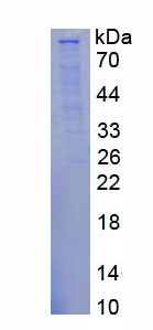 Figure . SDS-PAGE