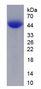 Figure . SDS-PAGE