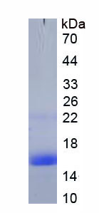Figure . SDS-PAGE